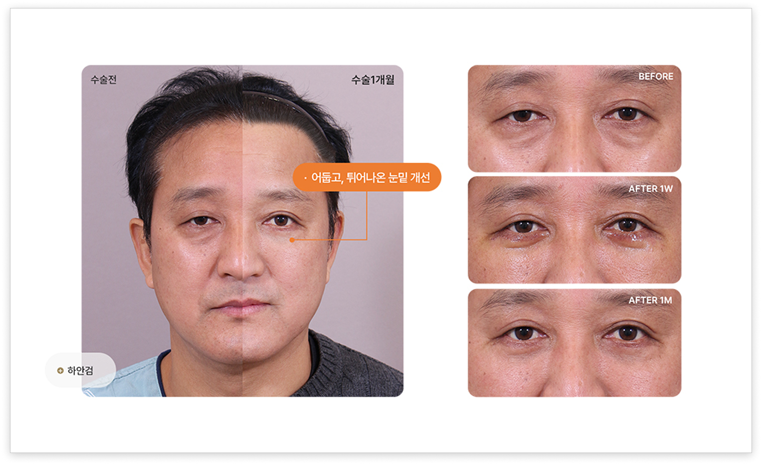 팝업 이미지