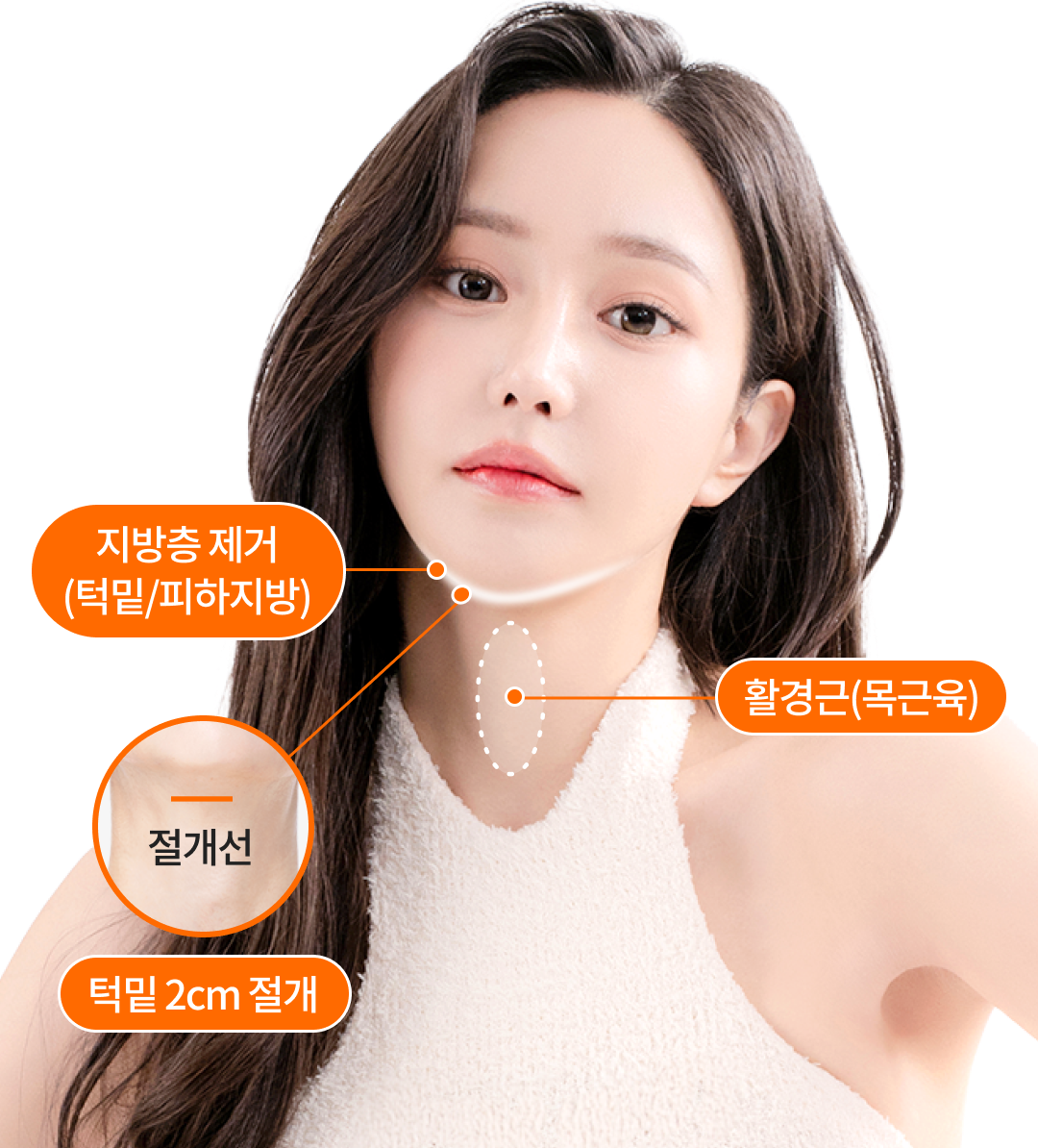 리엔장 이중턱 근육묶기가 돋보이는 이유