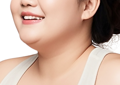 이중턱 근육묶기 이미지 1