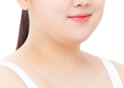 이중턱 근육묶기 이미지 2