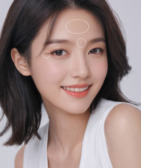 주름 3대장 교정해주는 엔도타인 이마거상술이란?