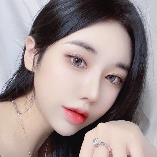 쌍꺼풀 수술 후 3개월