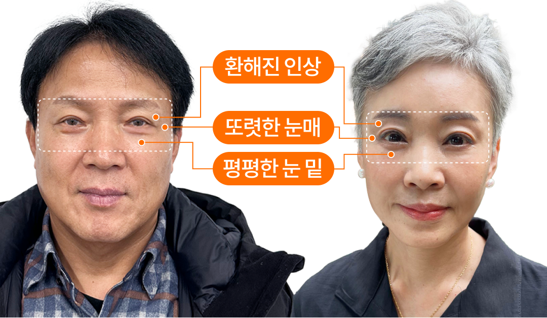 눈꺼풀 처짐? 눈 밑 처짐? 중년 눈성형 개인 솔루션이 필요합니다.