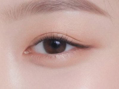 상안검