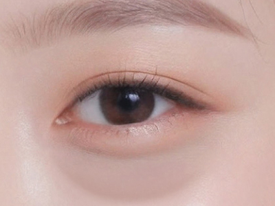 하안검