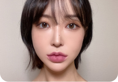 섬세한 박리 케이스 2
