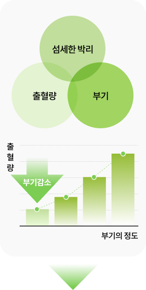섬세한 박리 이미지