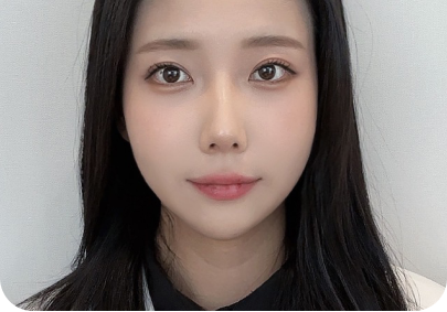 섬세한 박리 케이스 1