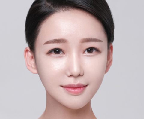 사각턱성형 수술 후