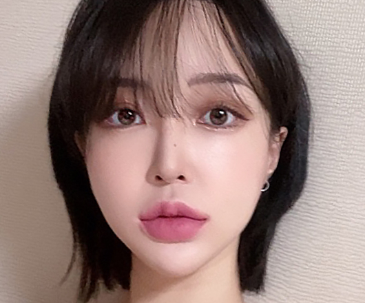 사각턱성형 수술 후