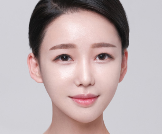 사각턱성형 수술 후