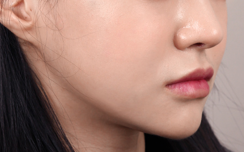 수술 후 이미지