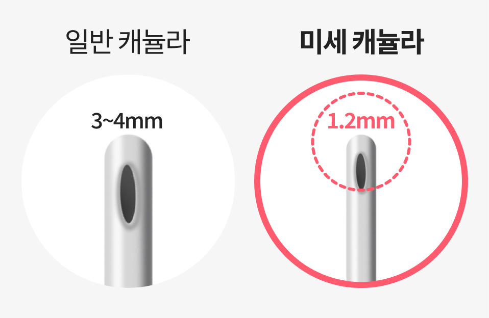 얼굴지방흡입을 위한 미세 캐뉼라 이미지