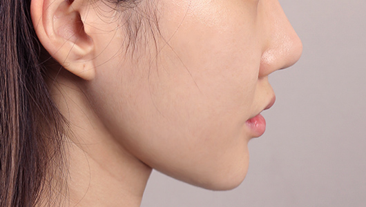 수술 후 이미지