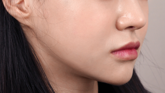 수술 후 이미지