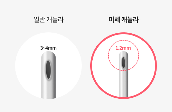얼굴지방흡입을 위한 미세 캐뉼라 이미지