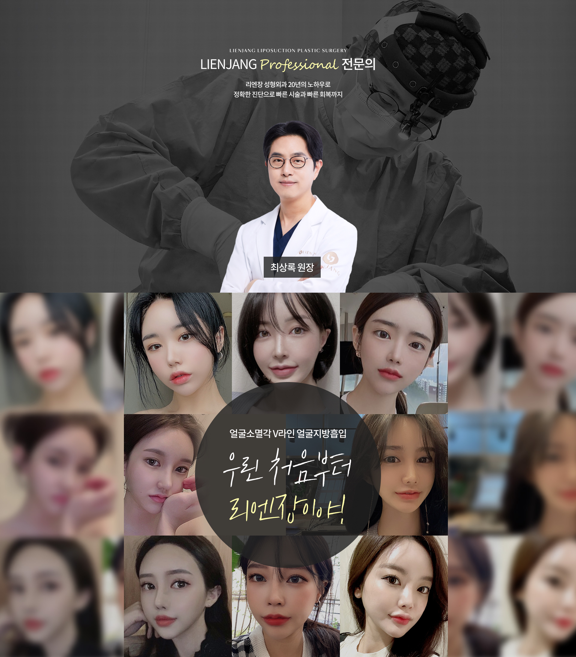 얼굴지방이식 공통 하단 이미지