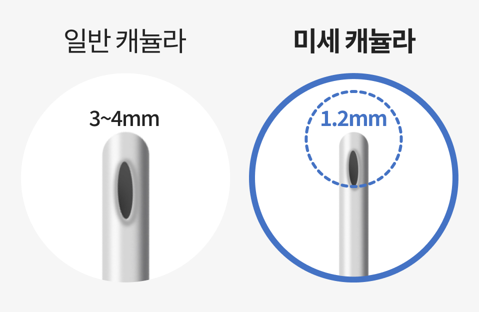 얼굴지방흡입을 위한 미세 캐뉼라 이미지