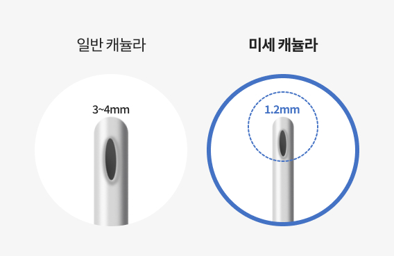 얼굴지방흡입을 위한 미세 캐뉼라 이미지