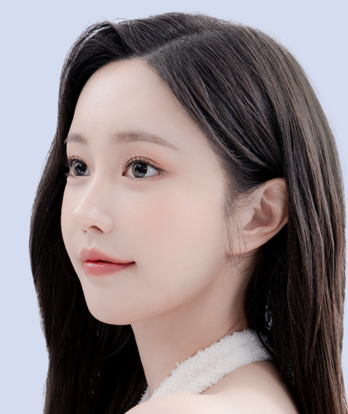 액티브 눈밑지방재배치 모델 이미지