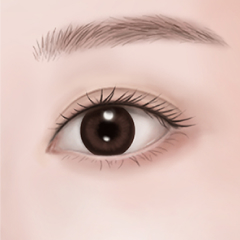 수술 후