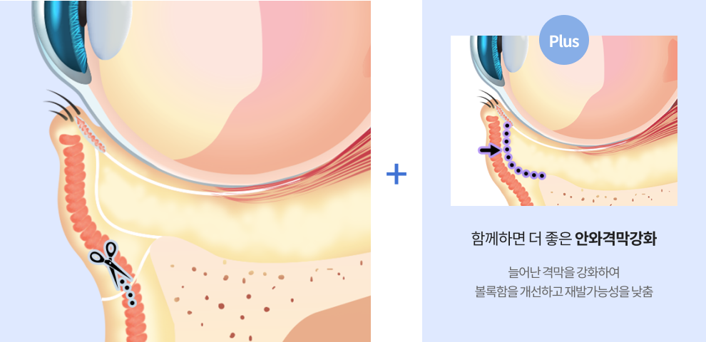누적 수술 건수 35,900건 돌파