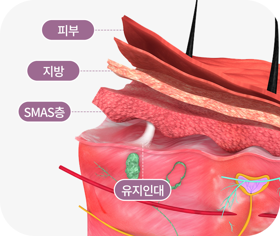 FULL HD 첨단 내시경 사용으로 근막층과 유지인대 박리