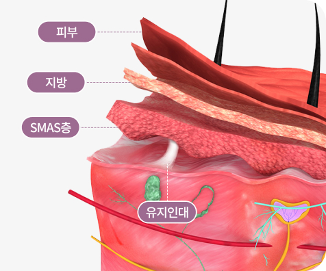 FULL HD 첨단 내시경 사용으로 근막층과 유지인대 박리