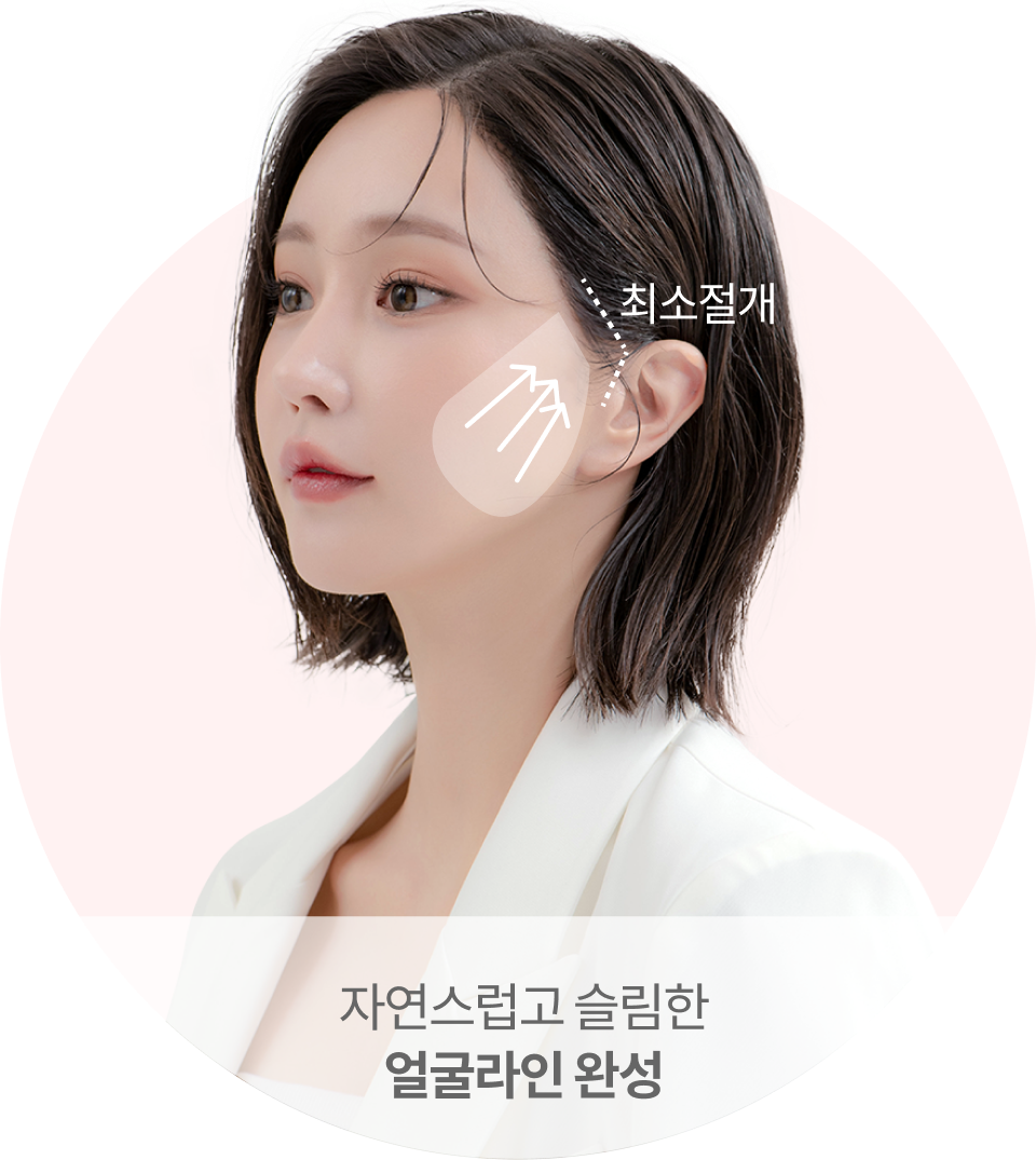 헤어라인 안쪽과 귀 앞쪽 라인을 최소절개하여 흉터 걱정 최소화