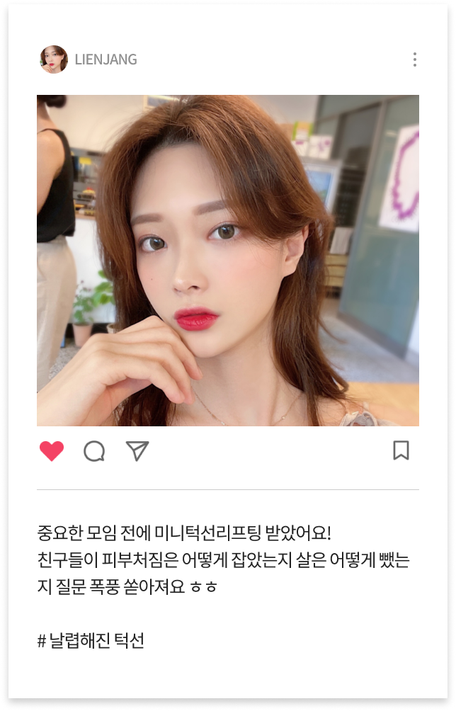미니턱선리프팅 수술 후 이미지