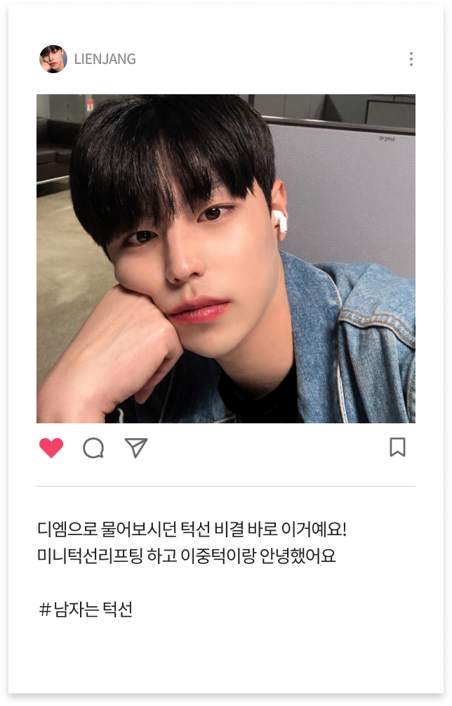미니턱선리프팅 수술 후 이미지