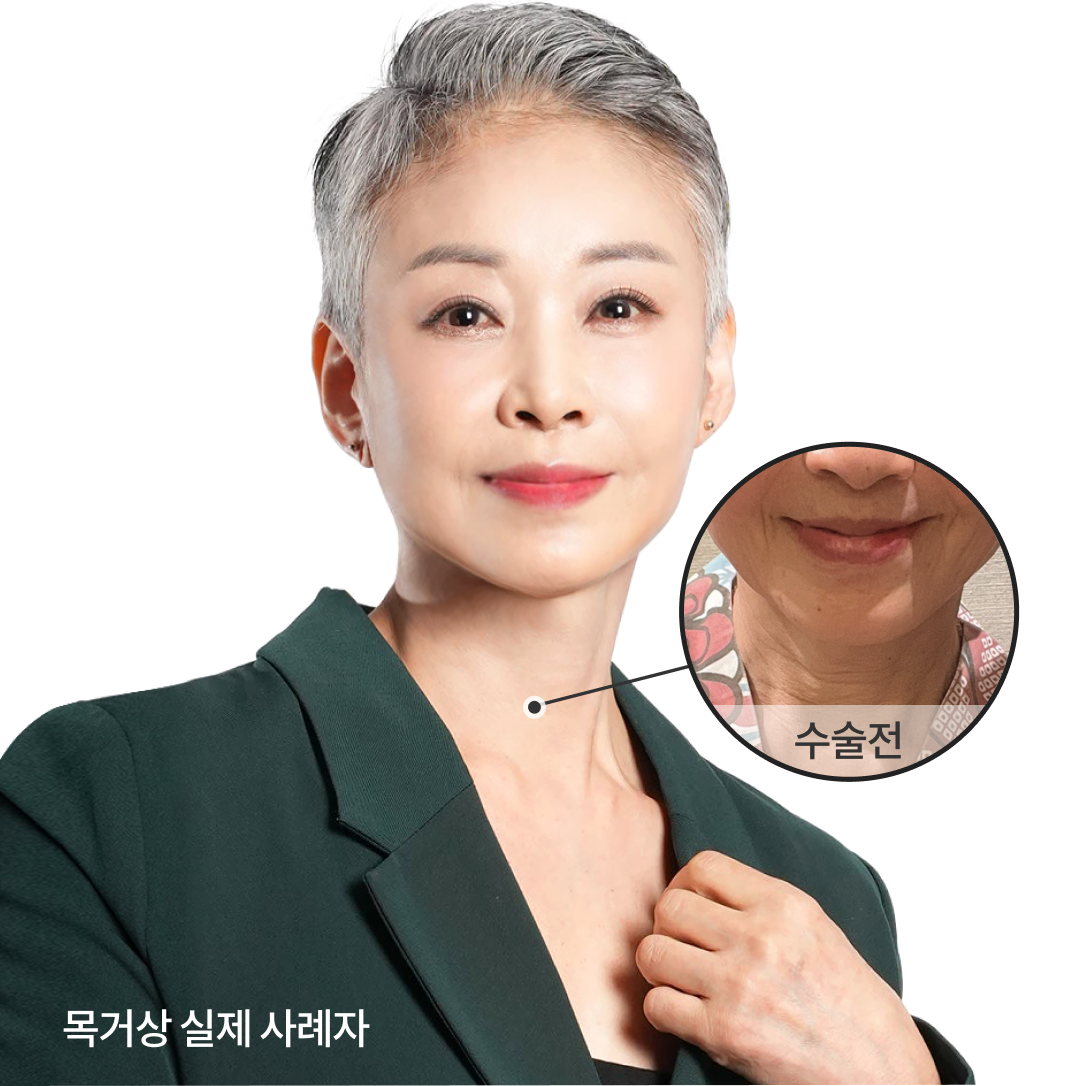 목거상 모델 이미지