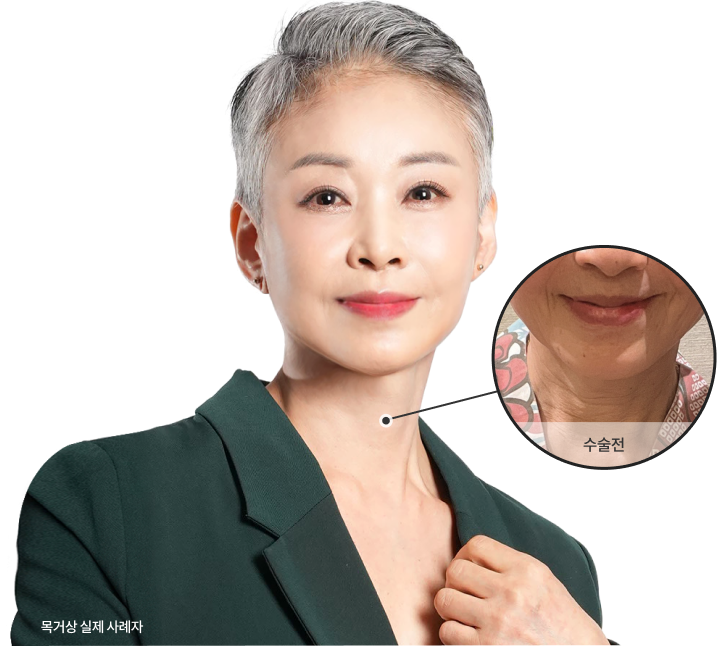 목거상 모델 이미지