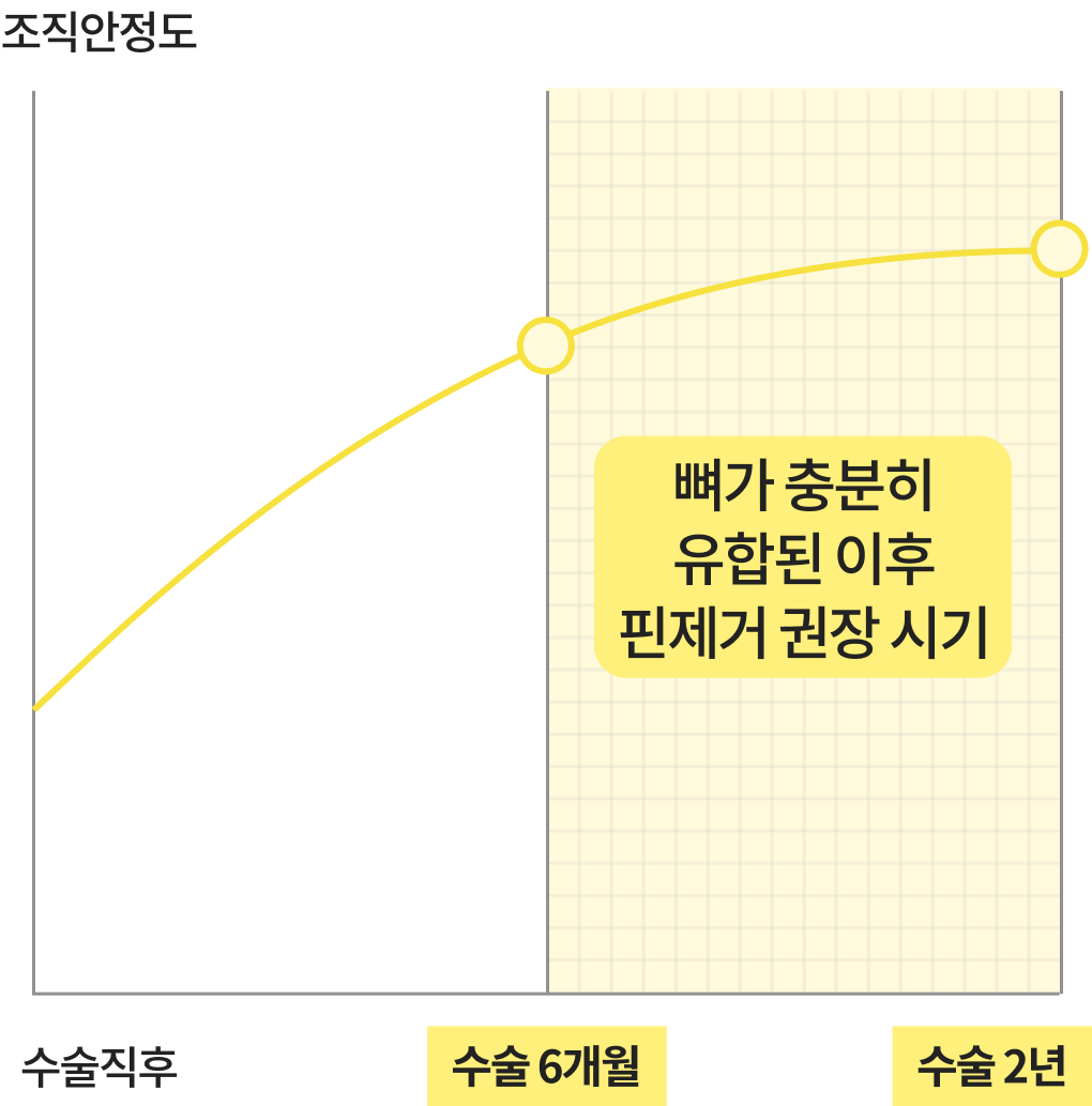 핀제거수술 최적의 타이밍 이미지