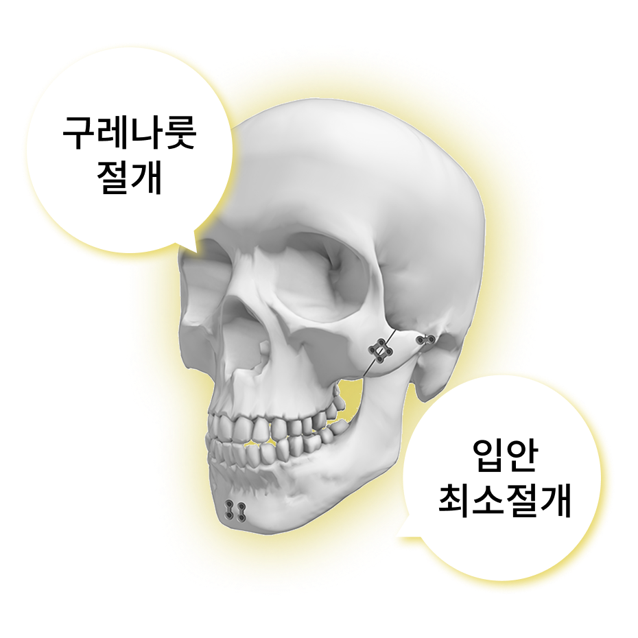 핀제거수술 안전하고 섬세한 핀 제거 수술법 이미지 1