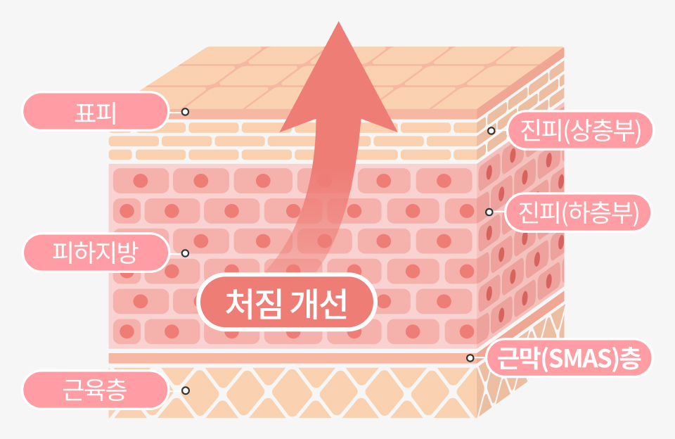 리엔장 팅쎄라 핵심포인트 3