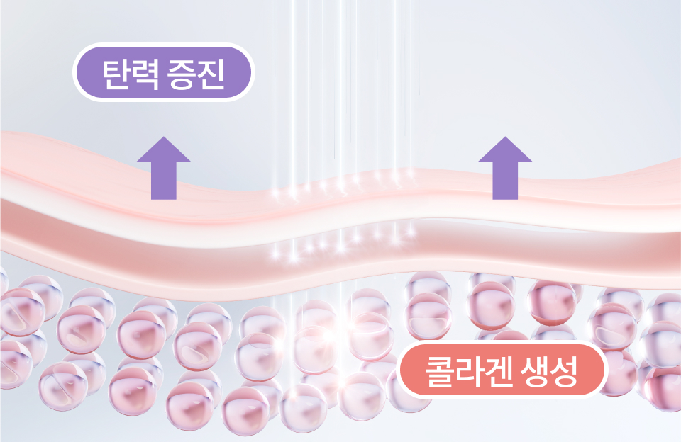 리엔장 팅쎄라 핵심포인트 4