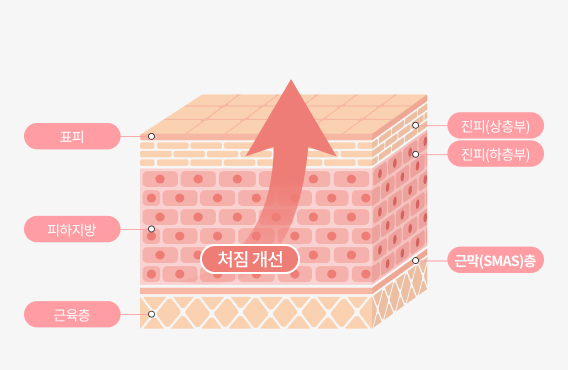 리엔장 팅쎄라 핵심포인트 3